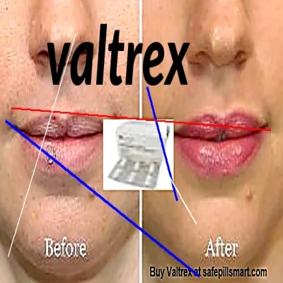 Acheter valtrex en ligne